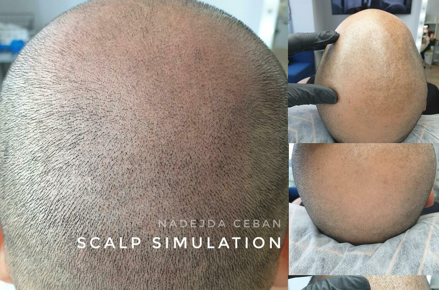 • SCALP SIMULATION В БУРГАС<br>